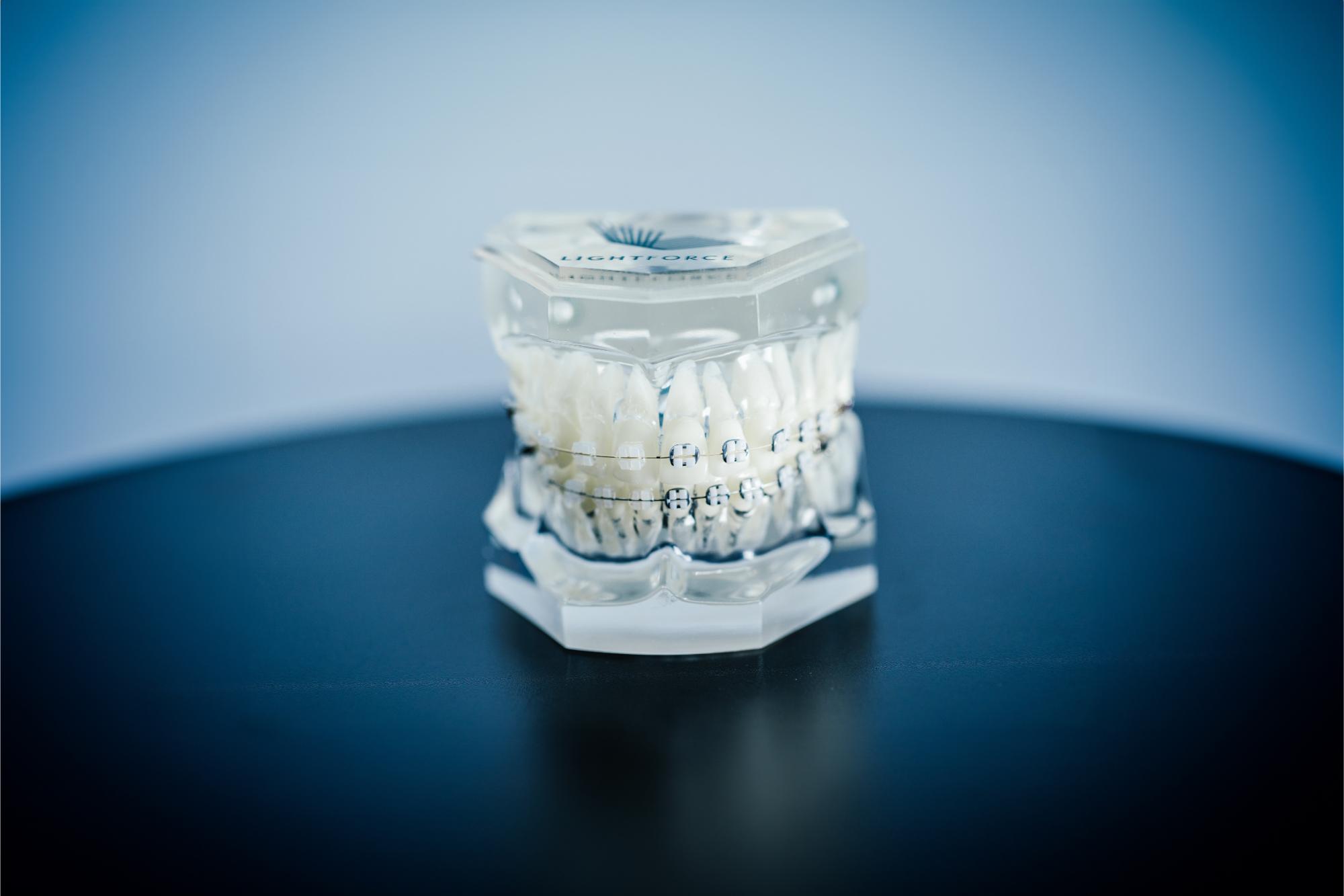 LightForce Clear Braces