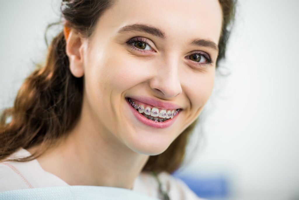 Close-up of a woman smiling with metal braces, treated by Dr. Ken Lawrence serving Kirtland, OH